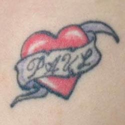 non laser tattoo removal cheltenham forever clinic cheltenham non laser tattoo removal cheltenham forever clinic cheltenham