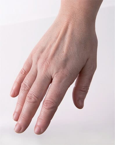 Skin Rejuvenating Injections Skin Rejuvenating Injections