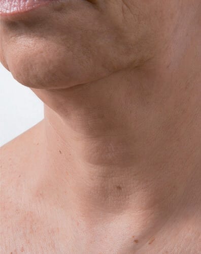 Skin Rejuvenating Injections Skin Rejuvenating Injections