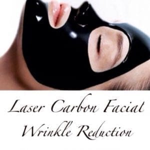 laser carbon facial wrinkle reduction